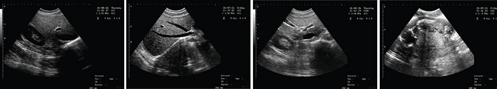 V-218全數(shù)字筆記本式動(dòng)物超聲診斷儀(動(dòng)物版)一流的數(shù)字成像技術(shù)，圖像更清晰
